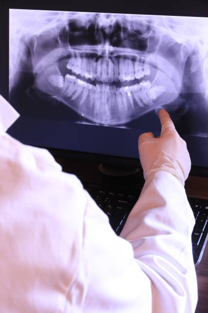 Best Emergency Wisdom Tooth Extraction in Pearl River, MS