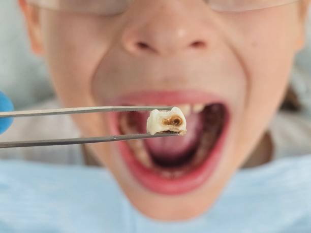 Best Emergency Treatment for Jaw Pain or Injury in Pearl River, MS